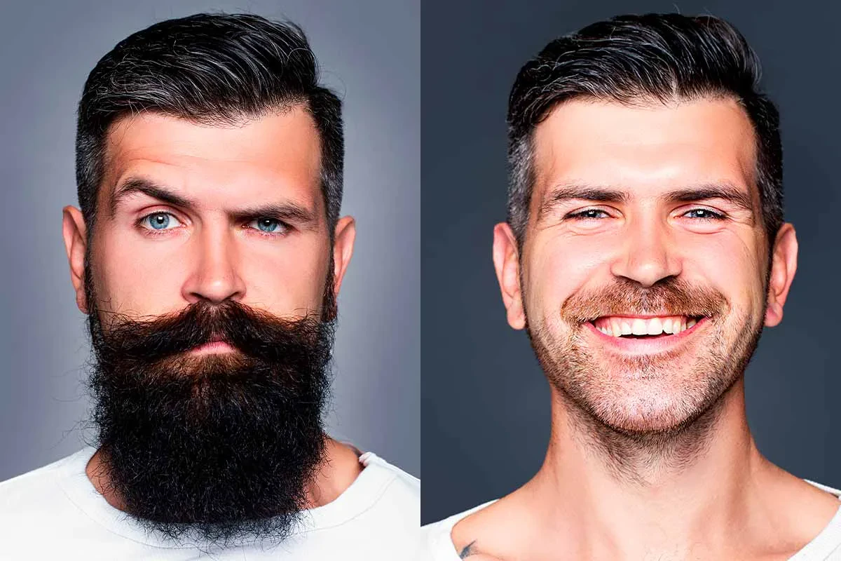 Man growing a beard